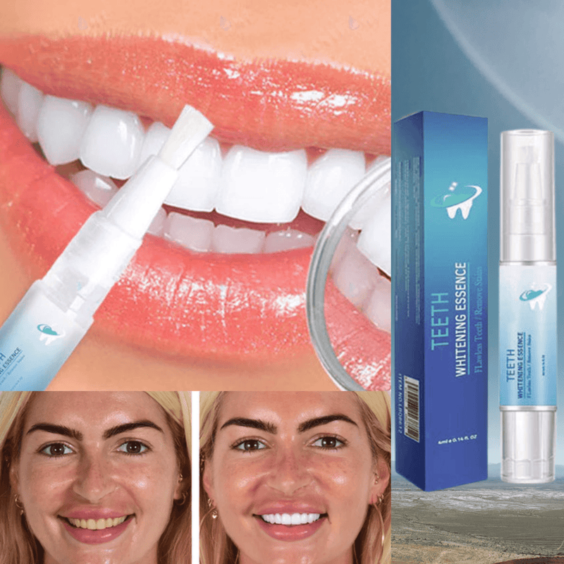 Penna Sbiancante per Denti | Siero Cosmetico per Denti Più Bianchi e Rimozione delle Macchie