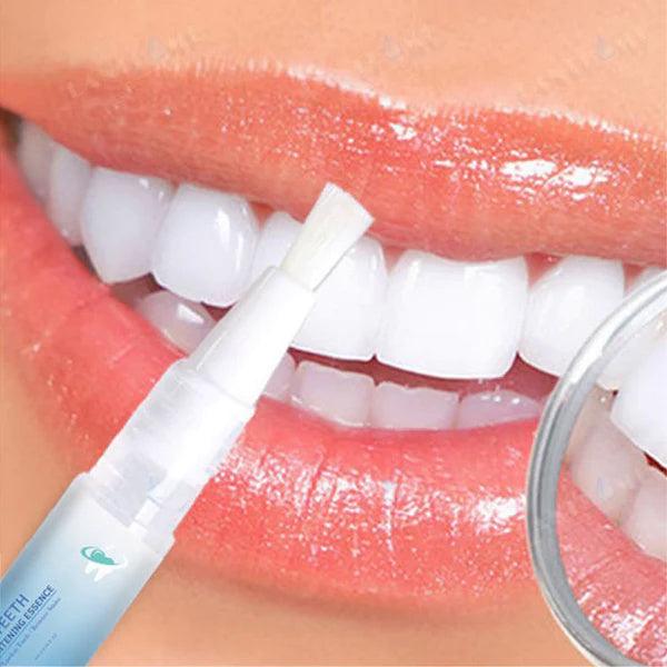 Penna Sbiancante per Denti | Siero Cosmetico per Denti Più Bianchi e Rimozione delle Macchie