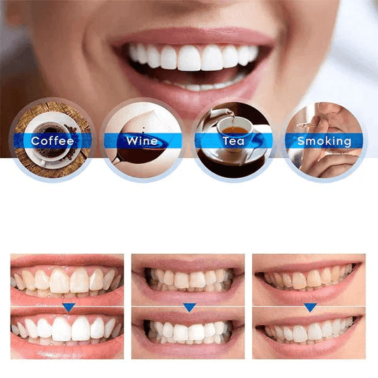 Penna Sbiancante per Denti | Siero Cosmetico per Denti Più Bianchi e Rimozione delle Macchie