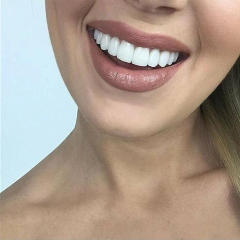 Riparazione dentale | SEMPRE IL SORRISO PERFETTO