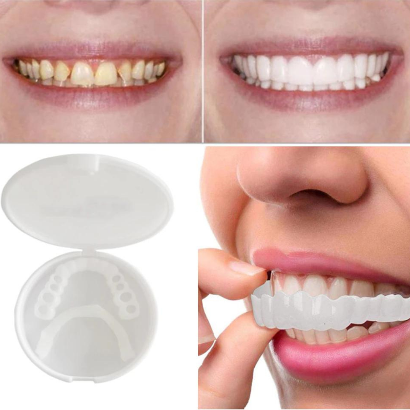 Riparazione dentale | SEMPRE IL SORRISO PERFETTO